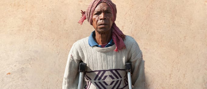 Pandemic Worsens the Hardships of Leprosy Patients